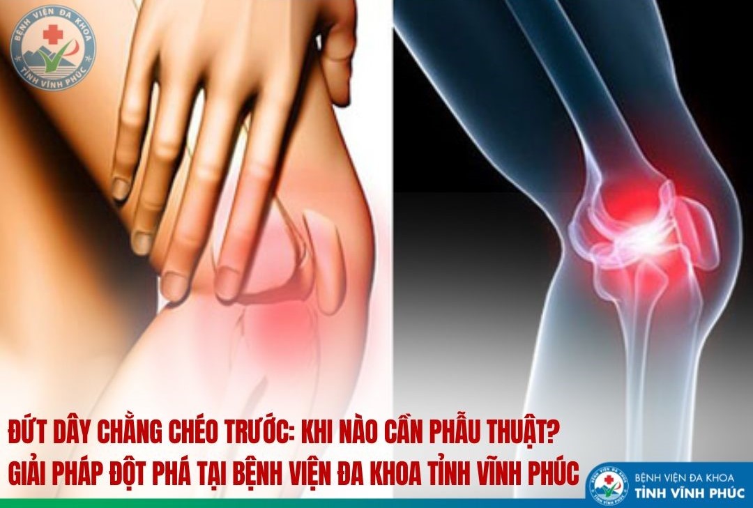 Đứt dây chằng chéo trước: Khi nào cần phẫu thuật và giải pháp đột phá tại Bệnh viện Đa khoa tỉnh Vĩnh Phúc
