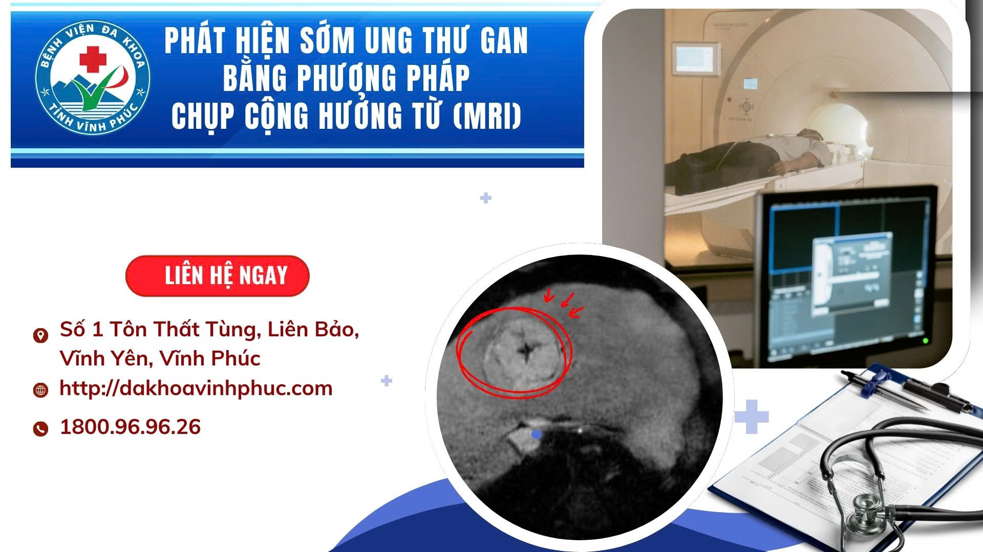 Phát hiện sớm ung thư gan bằng phương pháp chụp cộng hưởng từ (MRI)