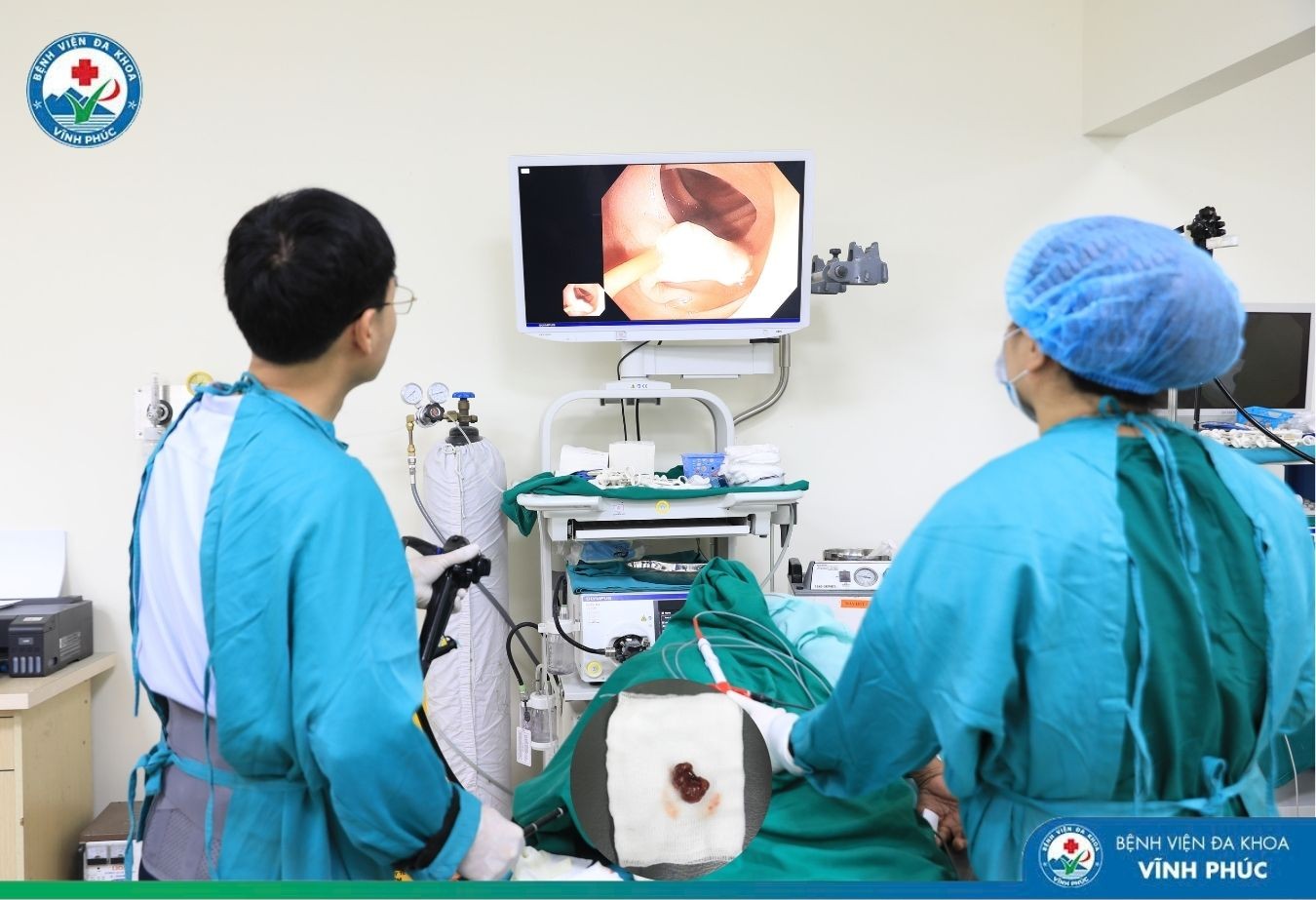 Phát hiện sớm polyp đại trực tràng: Bước ngoặt giúp người bệnh thoát khỏi nguy cơ ung thư