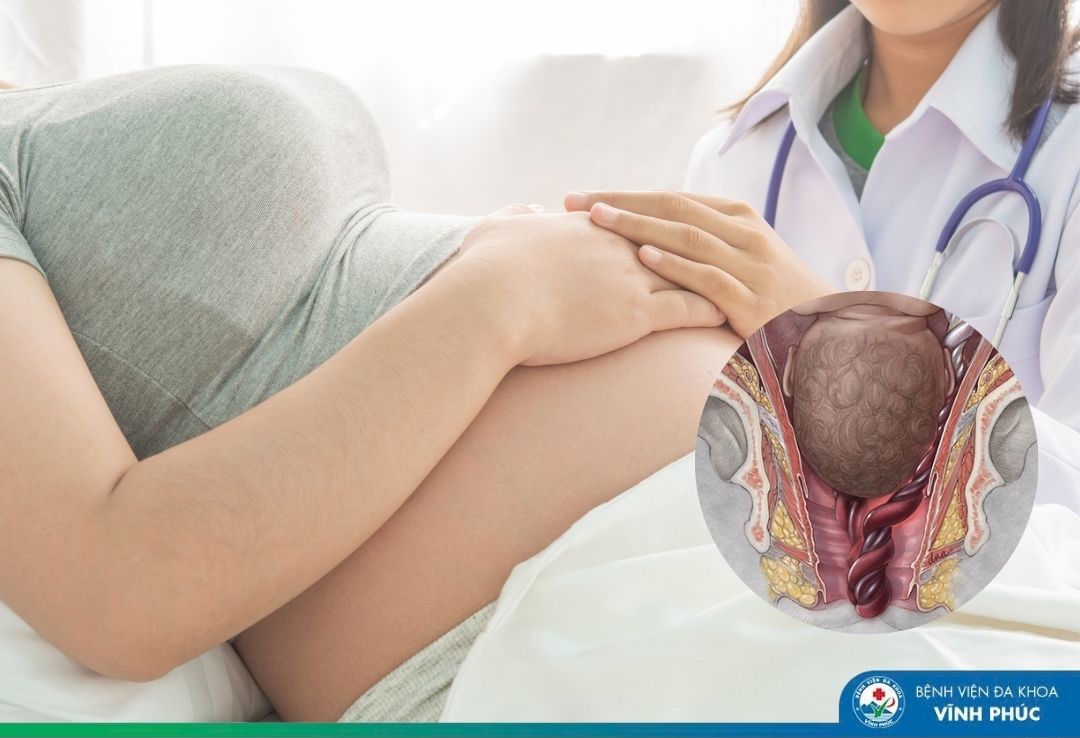 Cấp cứu thành công biến chứng sa dây rau nguy hiểm cho sản phụ 23 tuổi tại Bệnh viện Đa khoa Vĩnh Phúc