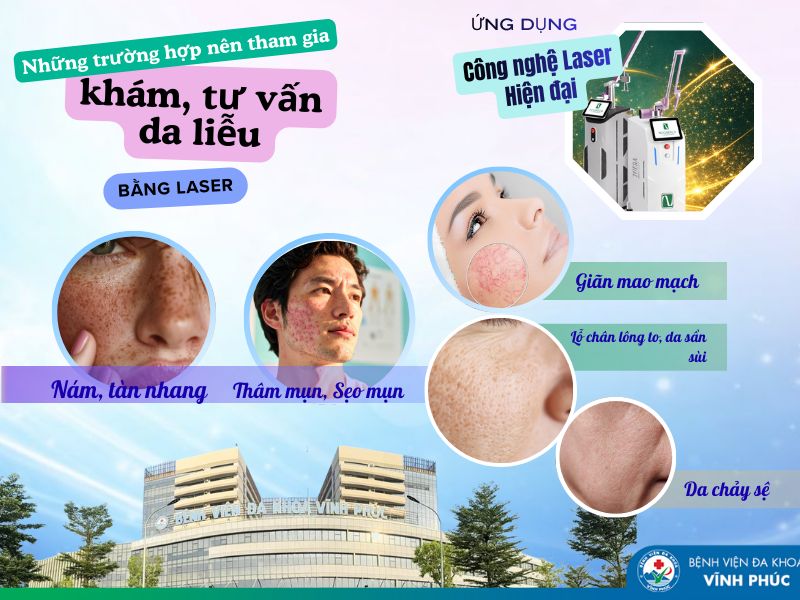 Những trường hợp nên tham gia chương trình khám và tư vấn da liễu bằng laser tại Bệnh viện Đa khoa Vĩnh Phúc